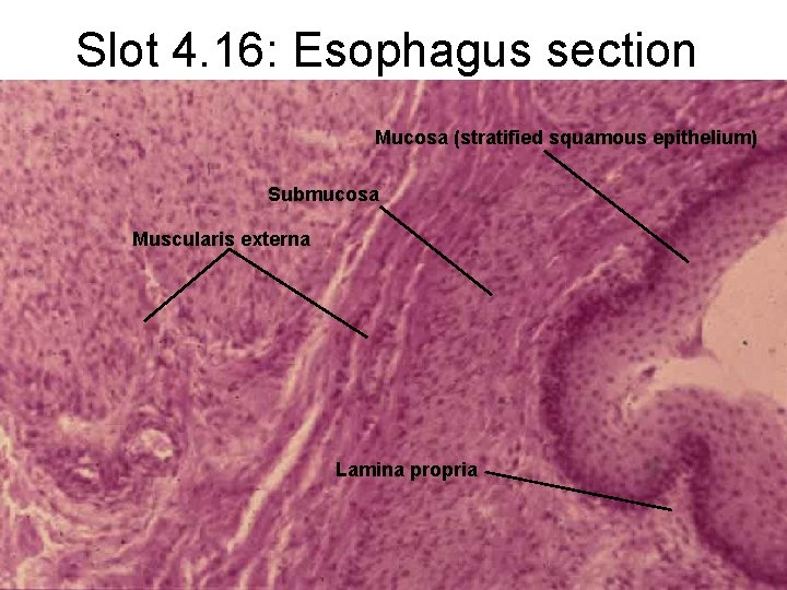 Slot 4. 16: Esophagus section Mucosa (stratified squamous epithelium) Submucosa Muscularis externa Lamina propria