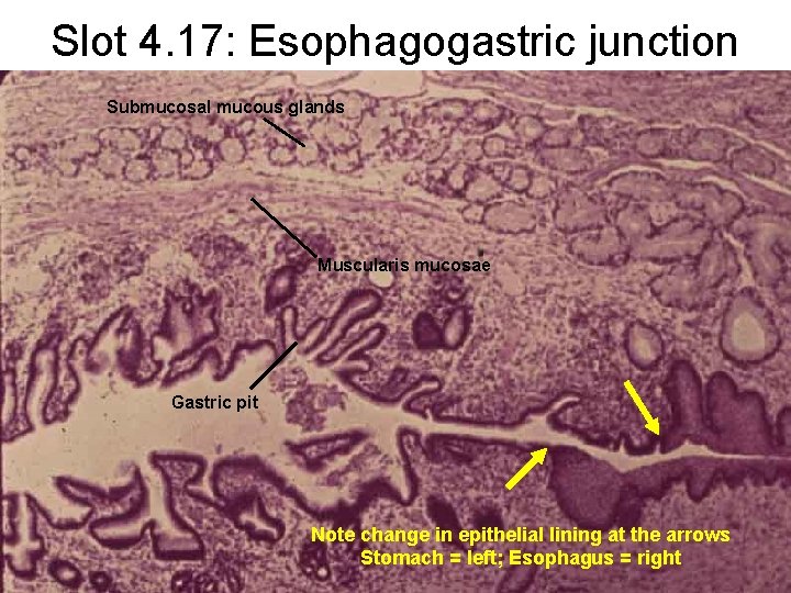 Slot 4. 17: Esophagogastric junction Submucosal mucous glands Muscularis mucosae Gastric pit Note change