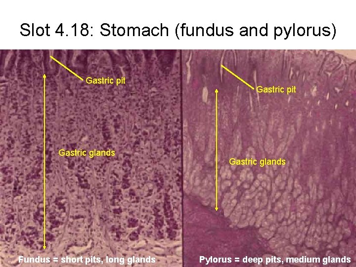 Slot 4. 18: Stomach (fundus and pylorus) Gastric pit Gastric glands Fundus = short