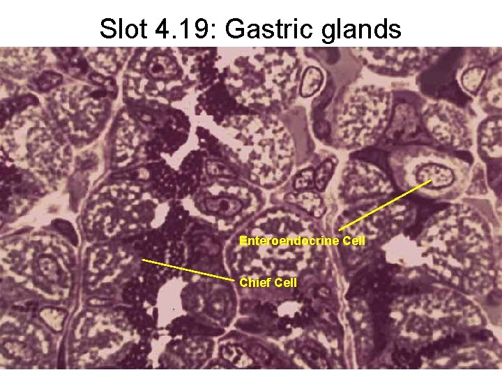 Slot 4. 19: Gastric glands Enteroendocrine Cell Chief Cell 