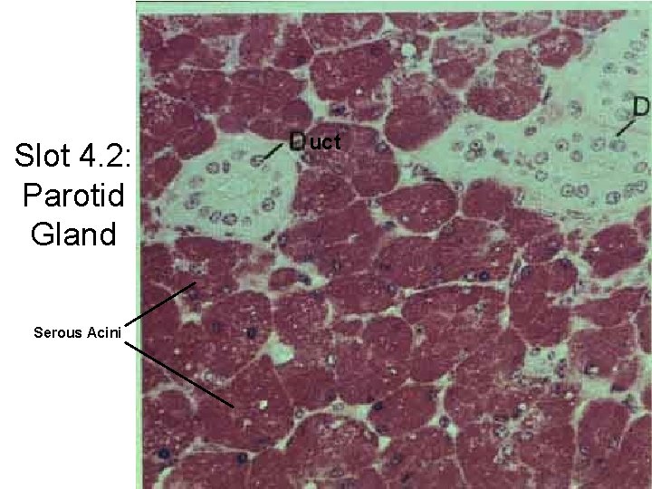 Slot 4. 2: Parotid Gland Serous Acini uct 