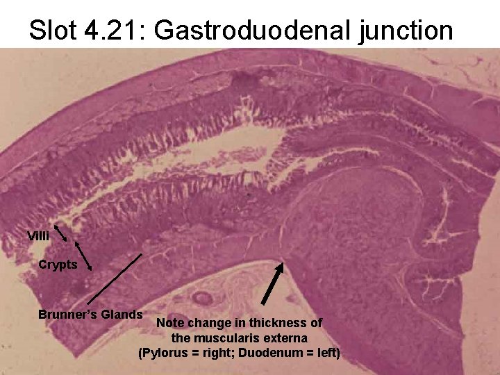 Slot 4. 21: Gastroduodenal junction Villi Crypts Brunner’s Glands Note change in thickness of