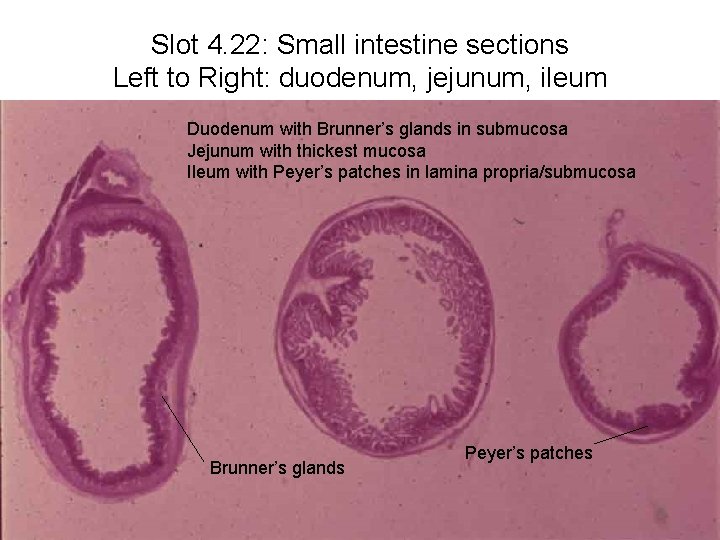 Slot 4. 22: Small intestine sections Left to Right: duodenum, jejunum, ileum Duodenum with