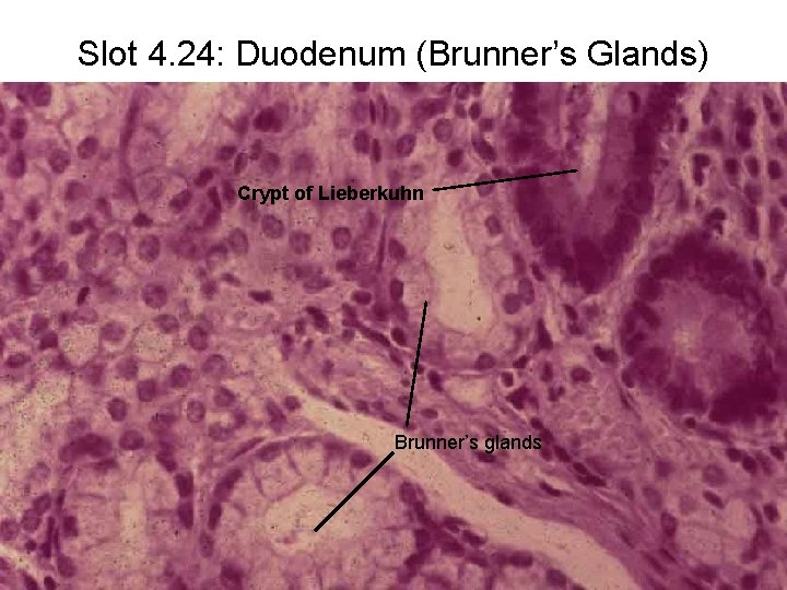 Slot 4. 24: Duodenum (Brunner’s Glands) Crypt of Lieberkuhn Brunner’s glands 