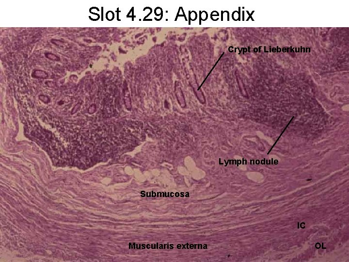 Slot 4. 29: Appendix Crypt of Lieberkuhn Lymph nodule Submucosa IC Muscularis externa OL