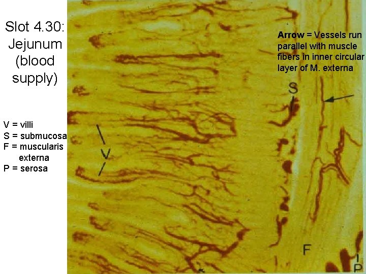 Slot 4. 30: Jejunum (blood supply) V = villi S = submucosa F =