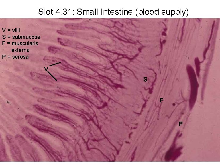 Slot 4. 31: Small Intestine (blood supply) V = villi S = submucosa F