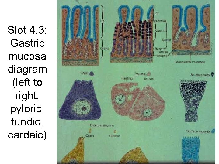 Slot 4. 3: Gastric mucosa diagram (left to right, pyloric, fundic, cardaic) 