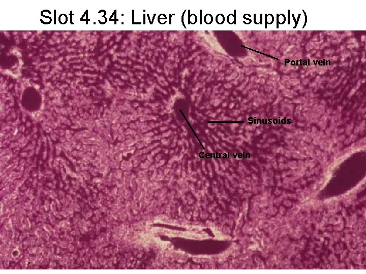 Slot 4. 34: Liver (blood supply) Portal vein Sinusoids Central vein 