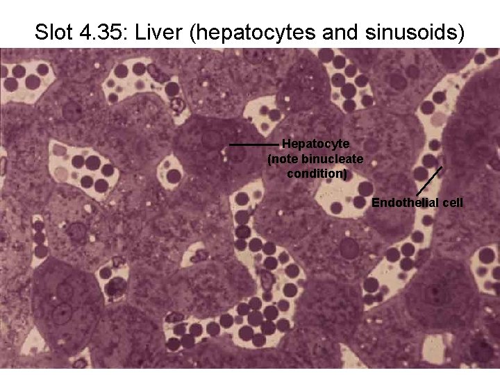 Slot 4. 35: Liver (hepatocytes and sinusoids) Hepatocyte (note binucleate condition) Endothelial cell 