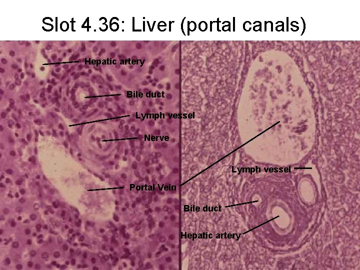 Slot 4. 36: Liver (portal canals) Hepatic artery Bile duct Lymph vessel Nerve Lymph