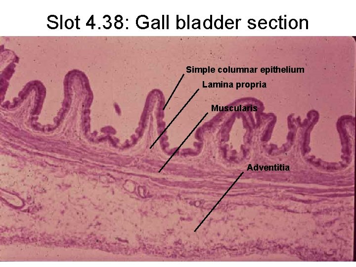 Slot 4. 38: Gall bladder section Simple columnar epithelium Lamina propria Muscularis Adventitia 