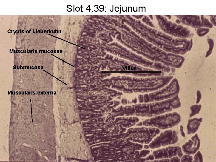 Slot 4. 39: Jejunum Crypts of Lieberkuhn Muscularis mucosae Submucosa Muscularis externa Villus 