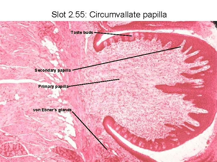 Slot 2. 55: Circumvallate papilla Taste buds Secondary papilla Primary papilla von Ebner’s glands