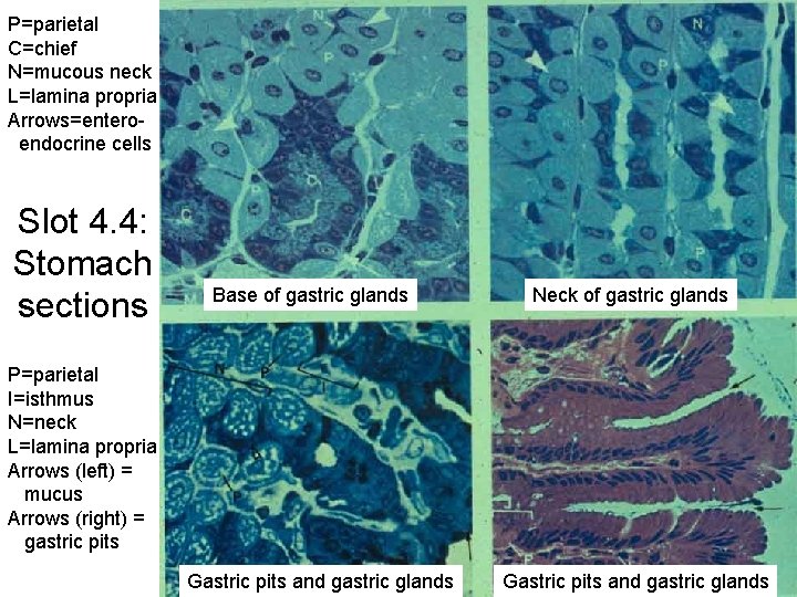 P=parietal C=chief N=mucous neck L=lamina propria Arrows=enteroendocrine cells Slot 4. 4: Stomach sections Base