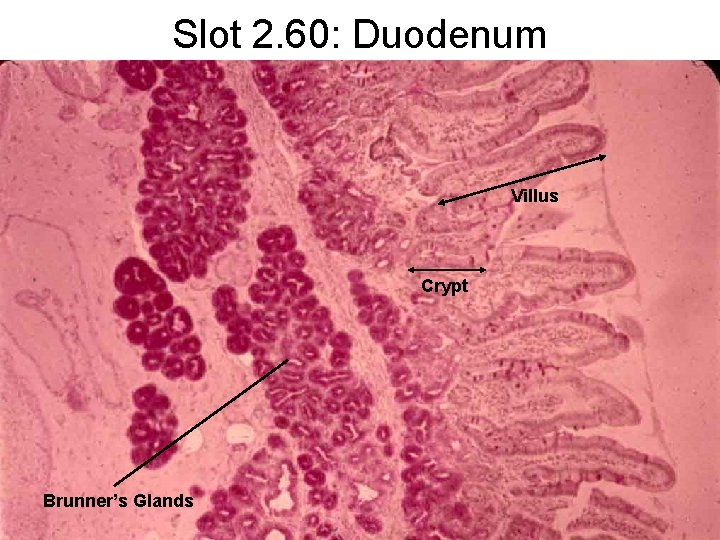 Slot 2. 60: Duodenum Villus Crypt Brunner’s Glands 