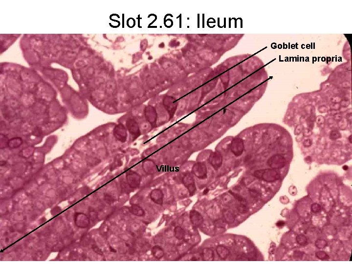 Slot 2. 61: Ileum Goblet cell Lamina propria Villus 