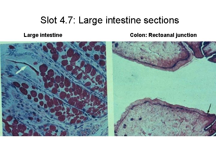 Slot 4. 7: Large intestine sections Large intestine Colon: Rectoanal junction 