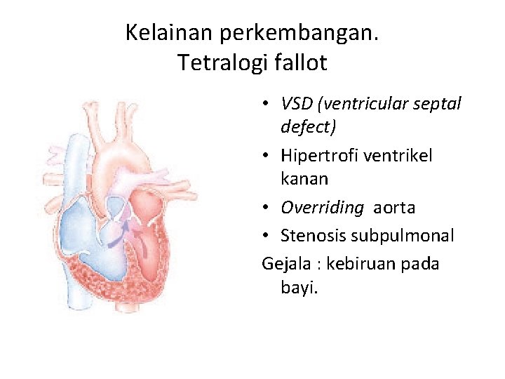 Kelainan perkembangan. Tetralogi fallot • VSD (ventricular septal defect) • Hipertrofi ventrikel kanan •