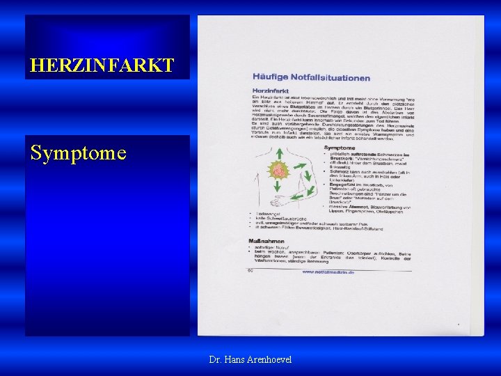 HERZINFARKT Symptome Dr. Hans Arenhoevel 