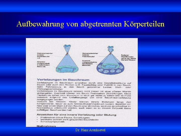 Aufbewahrung von abgetrennten Körperteilen Dr. Hans Arenhoevel 