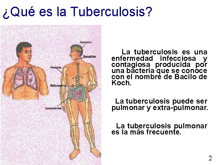 ¿Qué es la Tuberculosis? La tuberculosis es una enfermedad infecciosa y contagiosa producida por