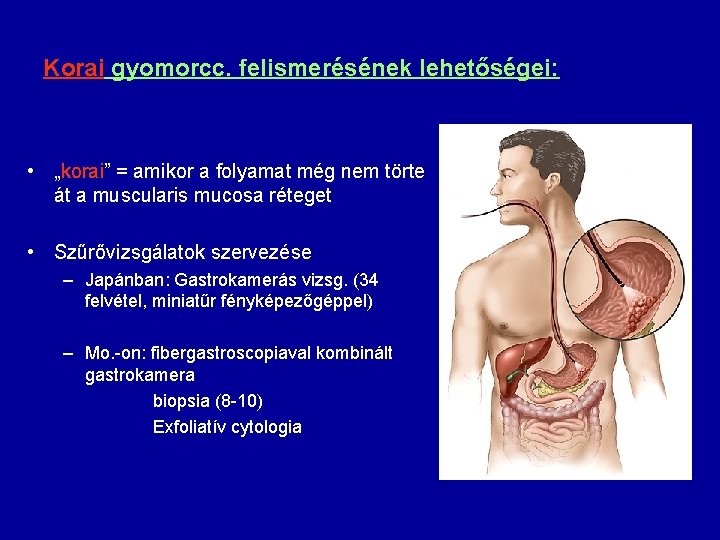 Korai gyomorcc. felismerésének lehetőségei: • „korai” = amikor a folyamat még nem törte át