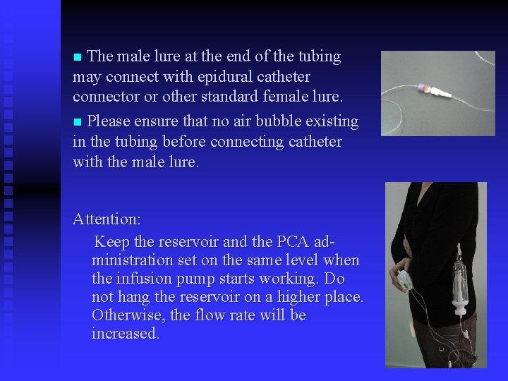 n The male lure at the end of the tubing may connect with epidural