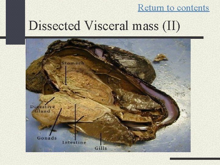 Return to contents Dissected Visceral mass (II) 