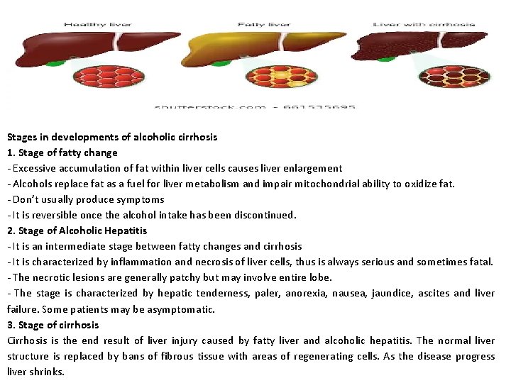Stages in developments of alcoholic cirrhosis 1. Stage of fatty change - Excessive accumulation