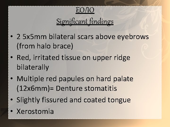 EO/IO Significant findings • 2 5 x 5 mm bilateral scars above eyebrows (from