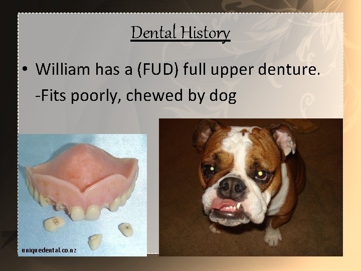 Dental History • William has a (FUD) full upper denture. -Fits poorly, chewed by