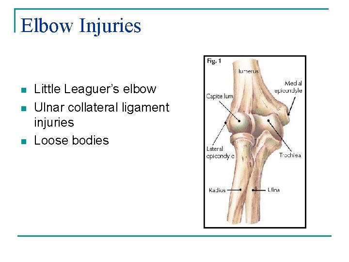Elbow Injuries n n n Little Leaguer’s elbow Ulnar collateral ligament injuries Loose bodies