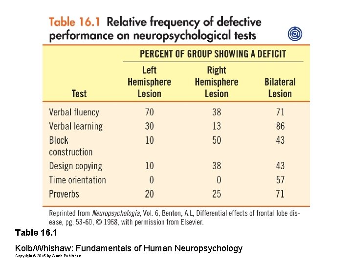 Table 16. 1 Kolb/Whishaw: Fundamentals of Human Neuropsychology Copyright © 2015 by Worth Publishers
