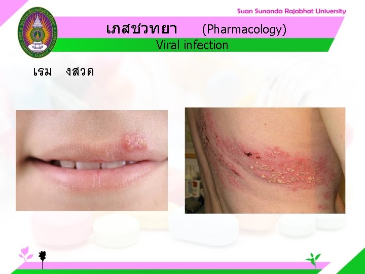 เภสชวทยา (Pharmacology) Viral infection เรม งสวด 