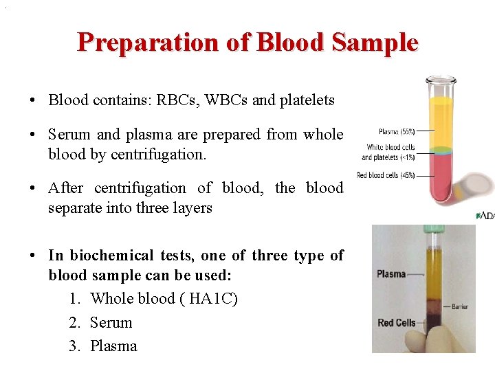 . Preparation of Blood Sample • Blood contains: RBCs, WBCs and platelets • Serum