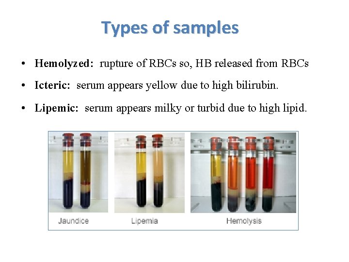 Types of samples • Hemolyzed: rupture of RBCs so, HB released from RBCs •