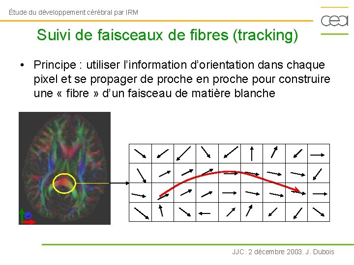 Étude du développement cérébral par IRM Suivi de faisceaux de fibres (tracking) • Principe