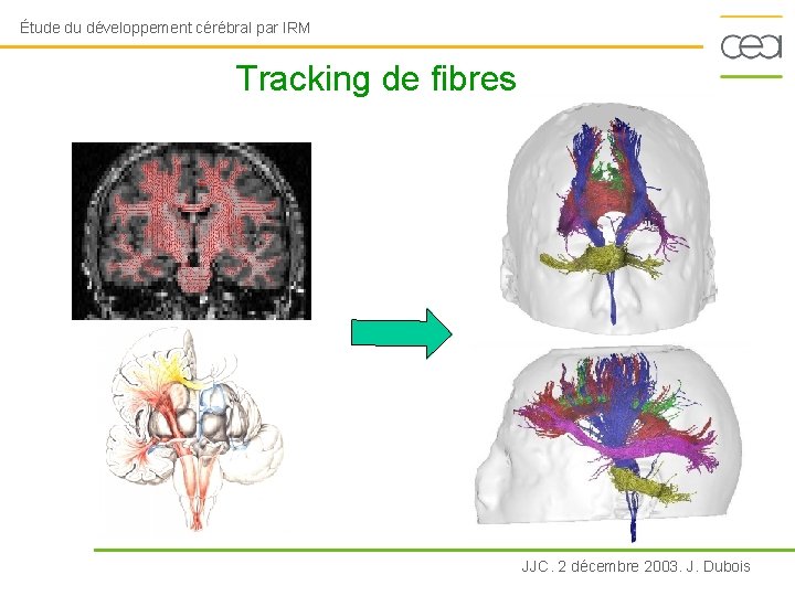 Étude du développement cérébral par IRM Tracking de fibres JJC. 2 décembre 2003. J.