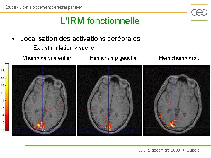 Étude du développement cérébral par IRM L’IRM fonctionnelle • Localisation des activations cérébrales Ex