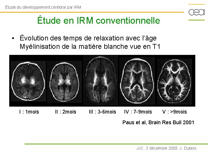 Étude du développement cérébral par IRM Étude en IRM conventionnelle • Évolution des temps