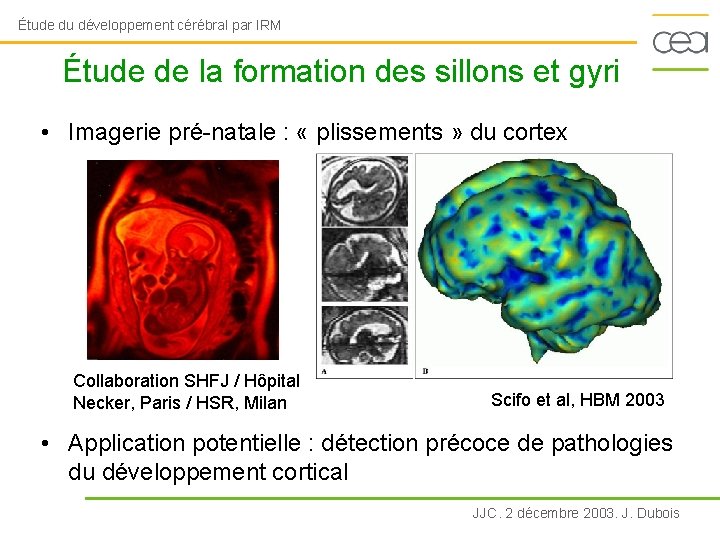 Étude du développement cérébral par IRM Étude de la formation des sillons et gyri