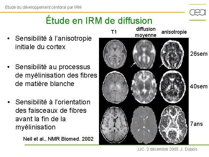 Étude du développement cérébral par IRM Étude en IRM de diffusion • Sensibilité à