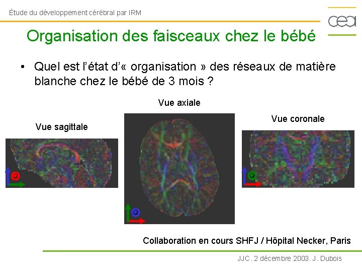 Étude du développement cérébral par IRM Organisation des faisceaux chez le bébé • Quel