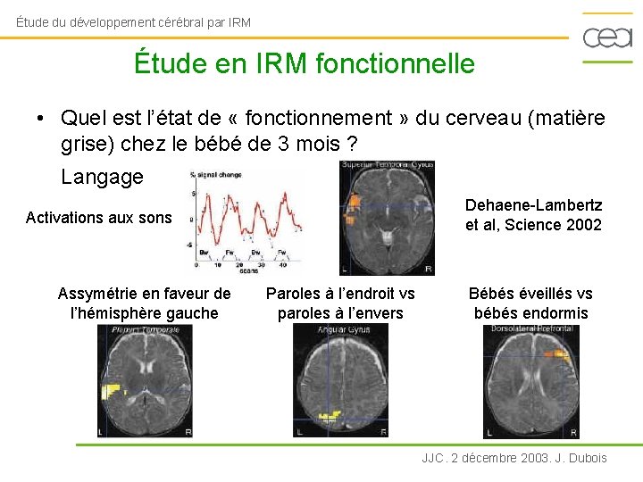 Étude du développement cérébral par IRM Étude en IRM fonctionnelle • Quel est l’état