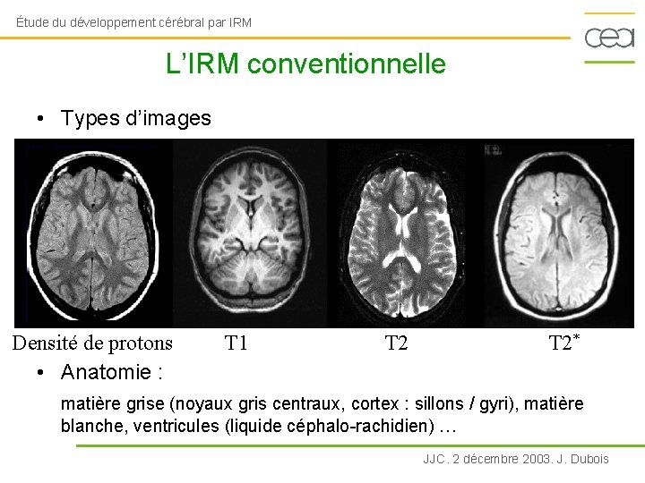 Étude du développement cérébral par IRM L’IRM conventionnelle • Types d’images Densité de protons