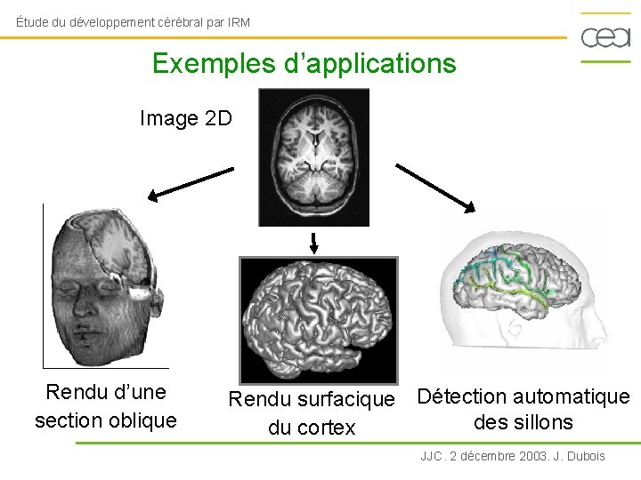 Étude du développement cérébral par IRM Exemples d’applications Image 2 D Rendu d’une section