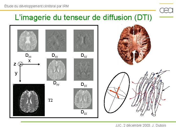 Étude du développement cérébral par IRM L’imagerie du tenseur de diffusion (DTI) Dxx z
