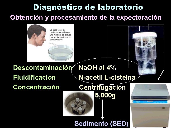 Diagnóstico de laboratorio Obtención y procesamiento de la expectoración Descontaminación Na. OH al 4%