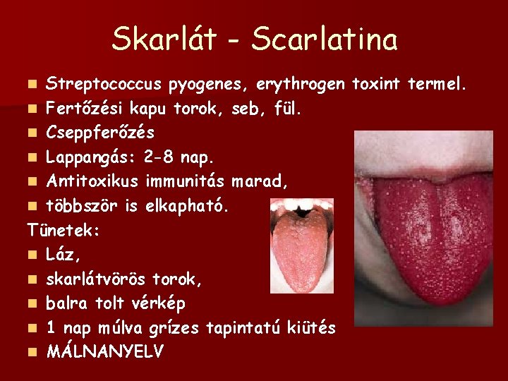 Skarlát - Scarlatina Streptococcus pyogenes, erythrogen toxint termel. n Fertőzési kapu torok, seb, fül.